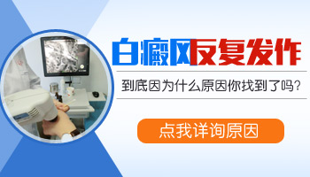 儿童脖颈长白癜风哪种疗法适合