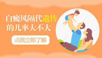 儿童面部有白块照uvb一次要多少钱