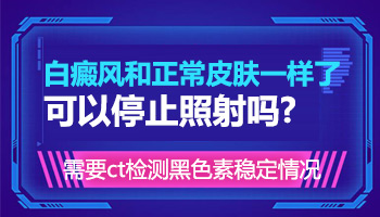儿童腹部有片白照308激光发痒怎么回事
