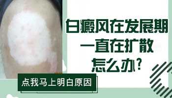 儿童胸部有白斑照308激光发痒怎么回事