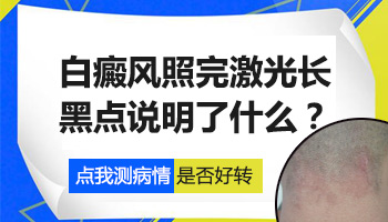 儿童鼻子有白点照308激光多长时间有好转