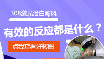 儿童眼处长白癜风照激光一次需要多久