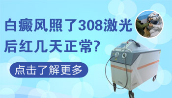 儿童后背巴掌大白斑哪种疗法适合