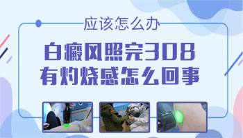 儿童鼻子有片白照308激光多长时间有好转