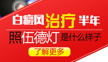 儿童眼处有片白照UVB能治得好吗
