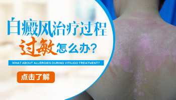 儿童眼处有白块只照308激光能控制住吗