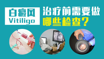 儿童脚部长白癜风照308激光3次不见效怎么办