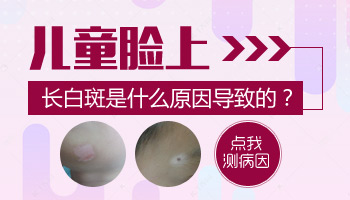 儿童胸部巴掌大白斑只吃药不照光能好吗
