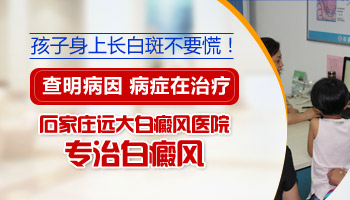 儿童腹部有白斑照308激光能治好吗