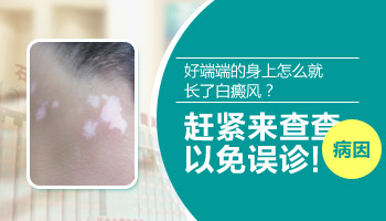 儿童面部有白点抹他克莫司多久能好