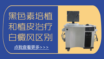 儿童鼻子巴掌大白斑照UVB能治得好吗