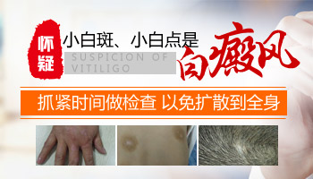 儿童肩膀巴掌大白斑照308激光多长时间有好转