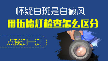 儿童额头巴掌大白斑在变大该怎么办