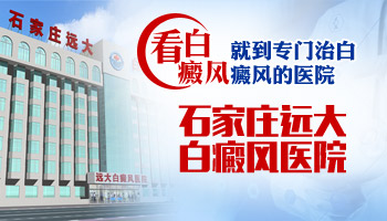 儿童手部长白癜风照UVB能治得好吗