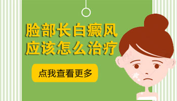 儿童头部长白癜风照308激光多长时间有好转