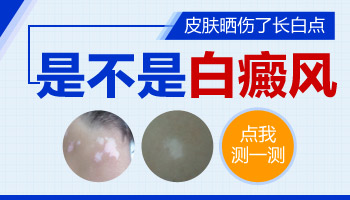 儿童后背有白块怎么治疗科学