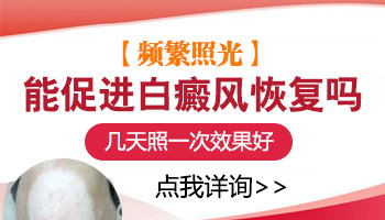 儿童腿上有白块照308好还是uvb效果好