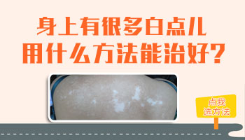 儿童腹部有白斑照uvb一次要多少钱