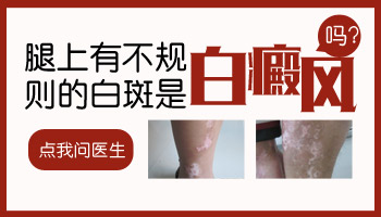儿童腹部有白块照308起泡了怎么办