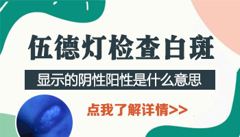 儿童下巴巴掌大白斑哪种疗法适合