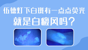 儿童头部有片白哪种疗法适合