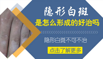 儿童腿上有白斑怎么回事