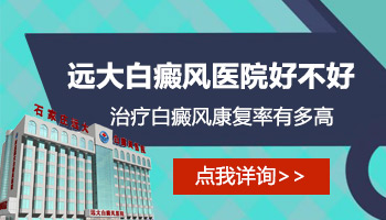 儿童后背有片白做308激光照多长时间合适