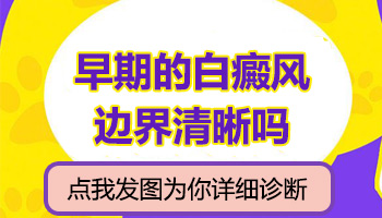 儿童脚部有片白照uvb一次要多少钱