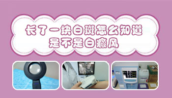 儿童面部有片白怎么回事