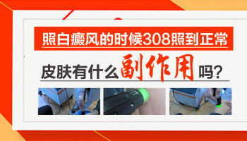 儿童脖颈有白块照完308红多久是正常的