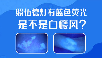 儿童脚部有白点怎么用药恢复的快