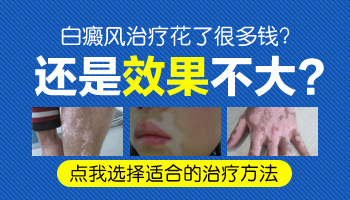 儿童下巴有白斑照激光一次需要多久