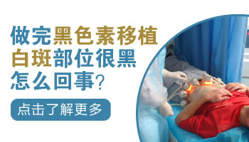 儿童头部有白点抹他克莫司多久能好