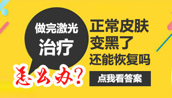 儿童后背有片白做308激光照多长时间合适