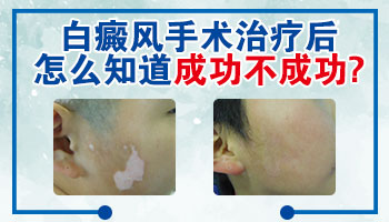 腿部有鸡蛋大白癜风去邢台哪看能治好”