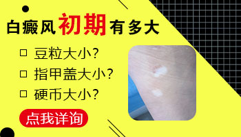 男孩脸上有一片白照uvb一次要多少钱