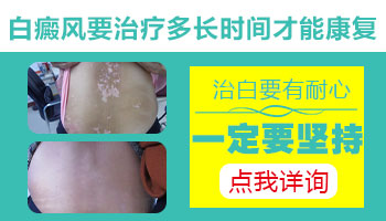 腰部长鸡蛋大小白癜风去石家庄哪治疗能治好