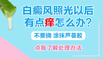 腹部发现扩散白癜风去邢台哪看效果好