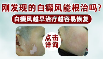 儿童脸上出现小白块擦他克莫司能好吗