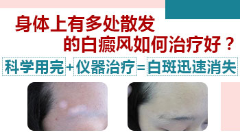 腰部长鸡蛋大小白癜风去邢台哪看比较好