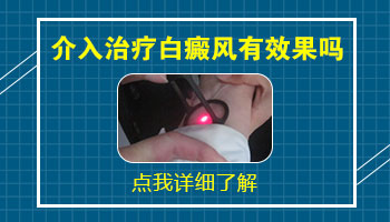 腰部出现小块白癜风去石家庄哪看效果好”