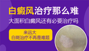 后背有大片白癜风去张家口哪治疗效果好