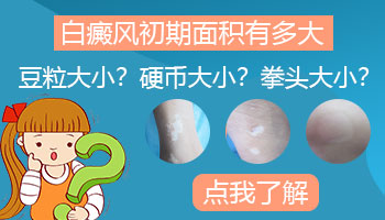 脸部有鸡蛋大白癜风去保定哪治疗能治好”