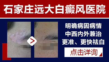 腹部有大面积白癜风去保定哪治疗比较好”