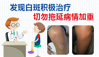 身上发现扩散白癜风去邢台哪看能治好