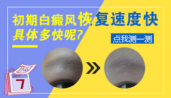 脸部长黄豆大白癜风去保定哪看效果好”