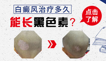 儿童脸上发现米粒大白斑多久照一次激光效果好