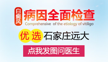 脸部长硬币大白癜风去廊坊哪治疗比较好