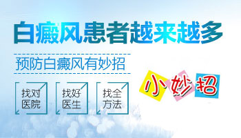 身上有早期白癜风去石家庄哪看比较好
