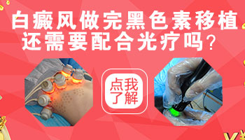 后背长鸡蛋大小白癜风去邢台哪治疗效果好